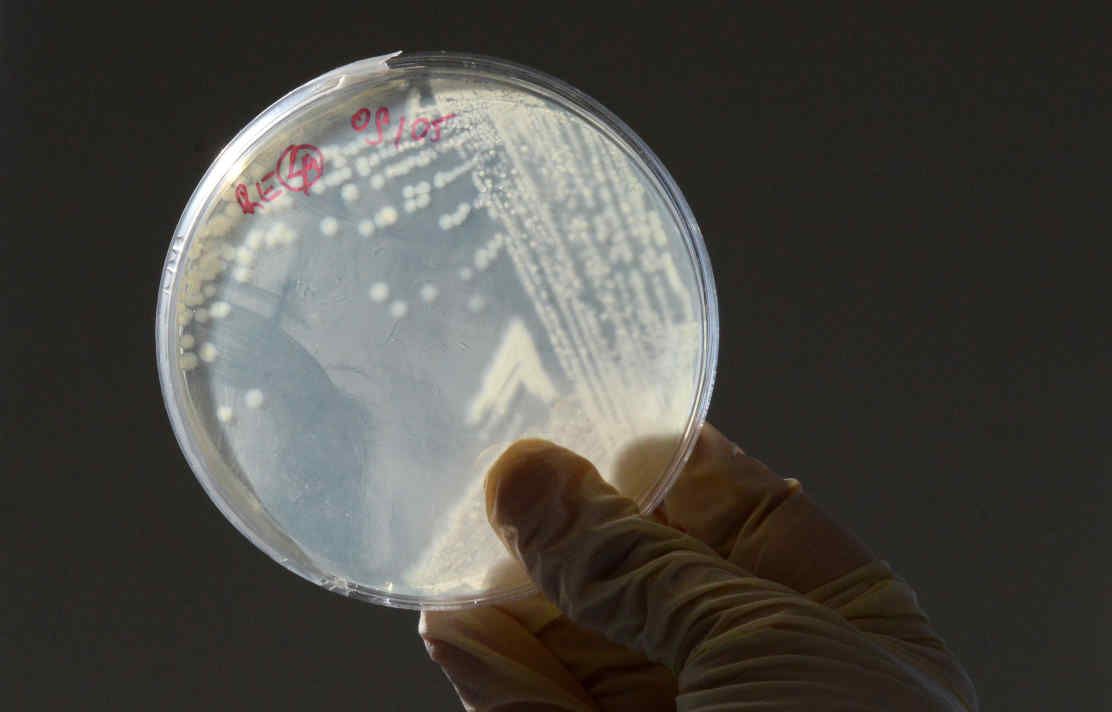 Bacteria on agar plate held up to light