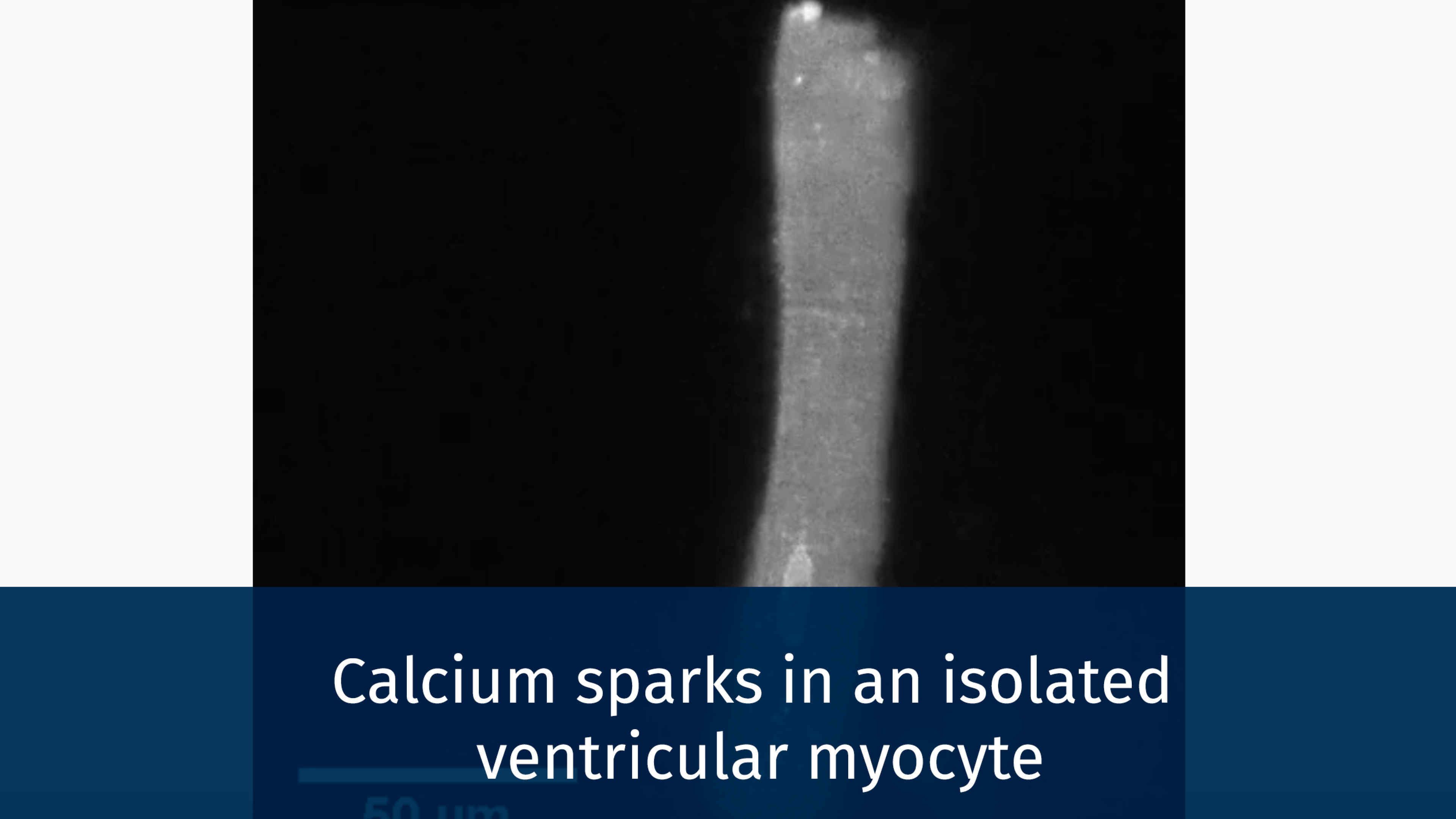 single myocyte