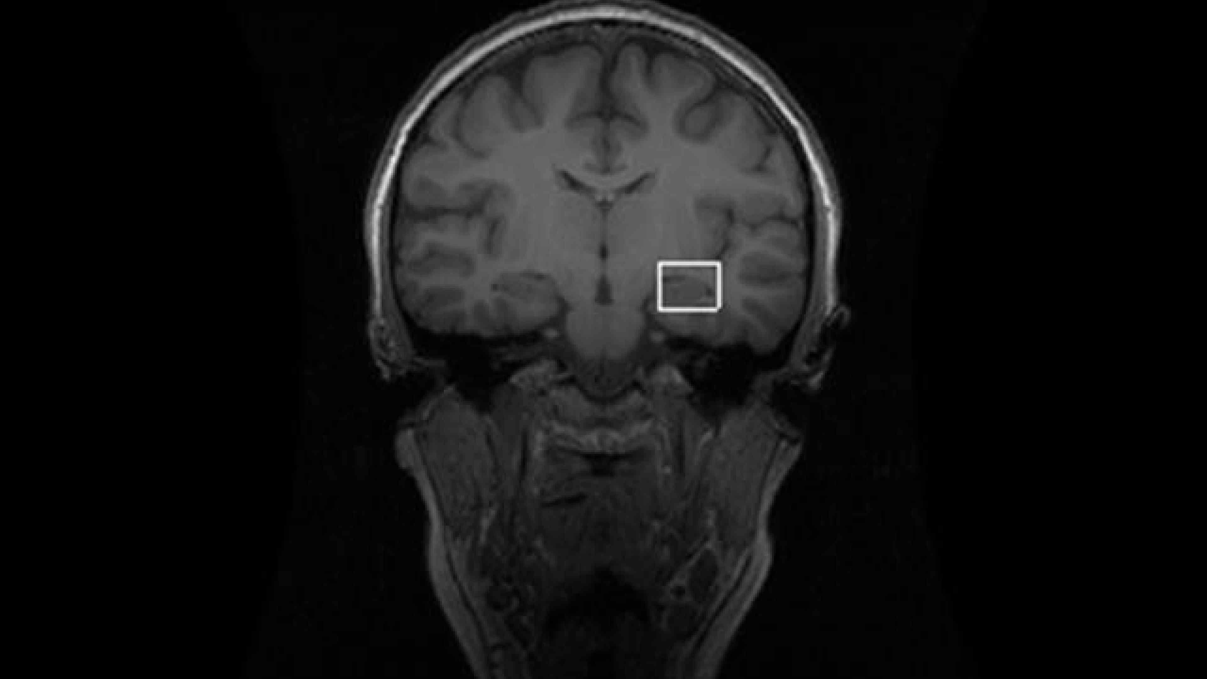MRes Bioimaging Sciences
