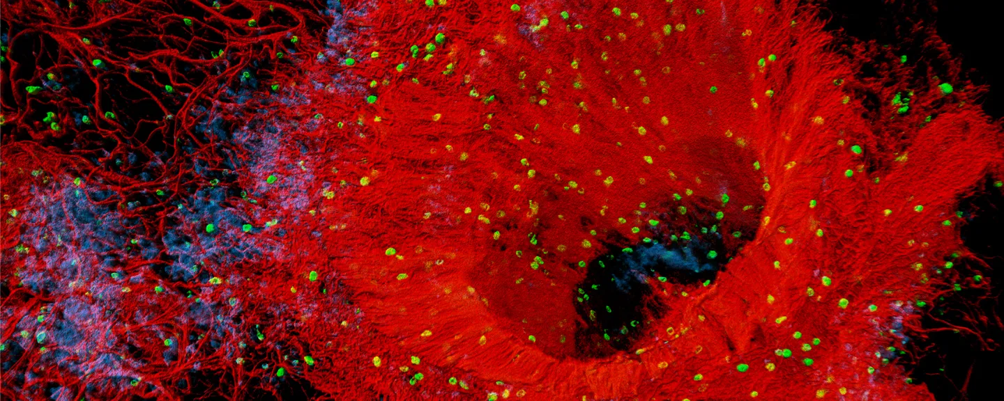 Microscopic image captured in the National Heart and Lung Institute, showing detail in the lung. The Human lung vasculature is shown in red with pericytes (blue) and mast cells (green).