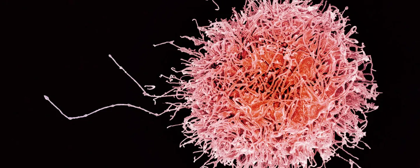 Colorized scanning electron micrograph of a natural killer cell from a human donor. Credit: NIAID