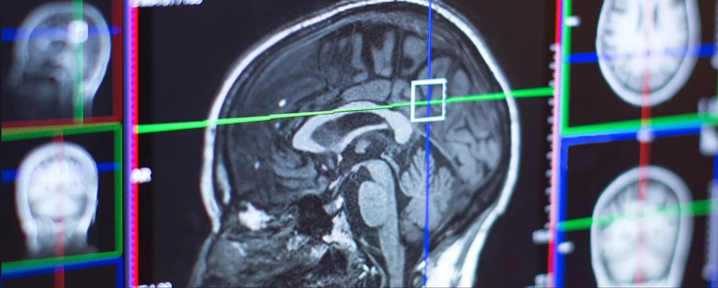 A scan of a human head