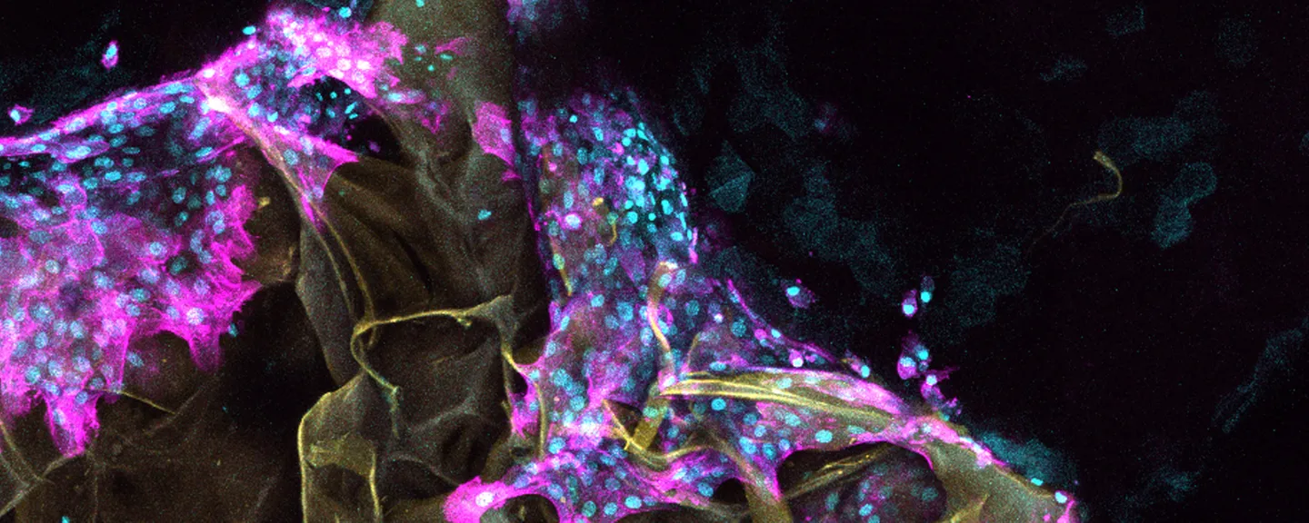 A photo of TrAPs DNA Super Plaster