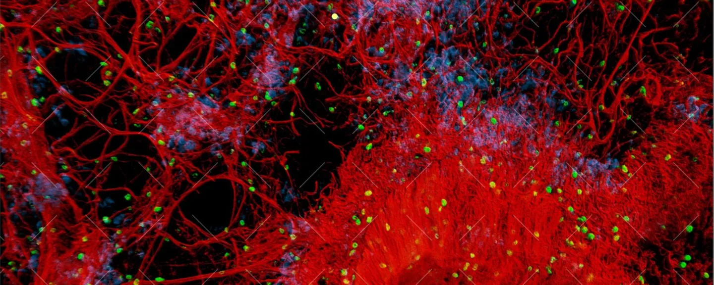 Lung Vasculature image