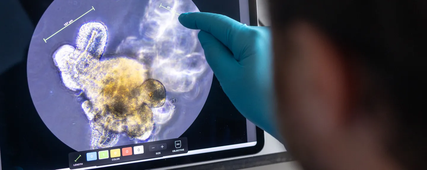 Prof. Korcsmaros works on computational and experimental approaches to study signalling networks in the gut.