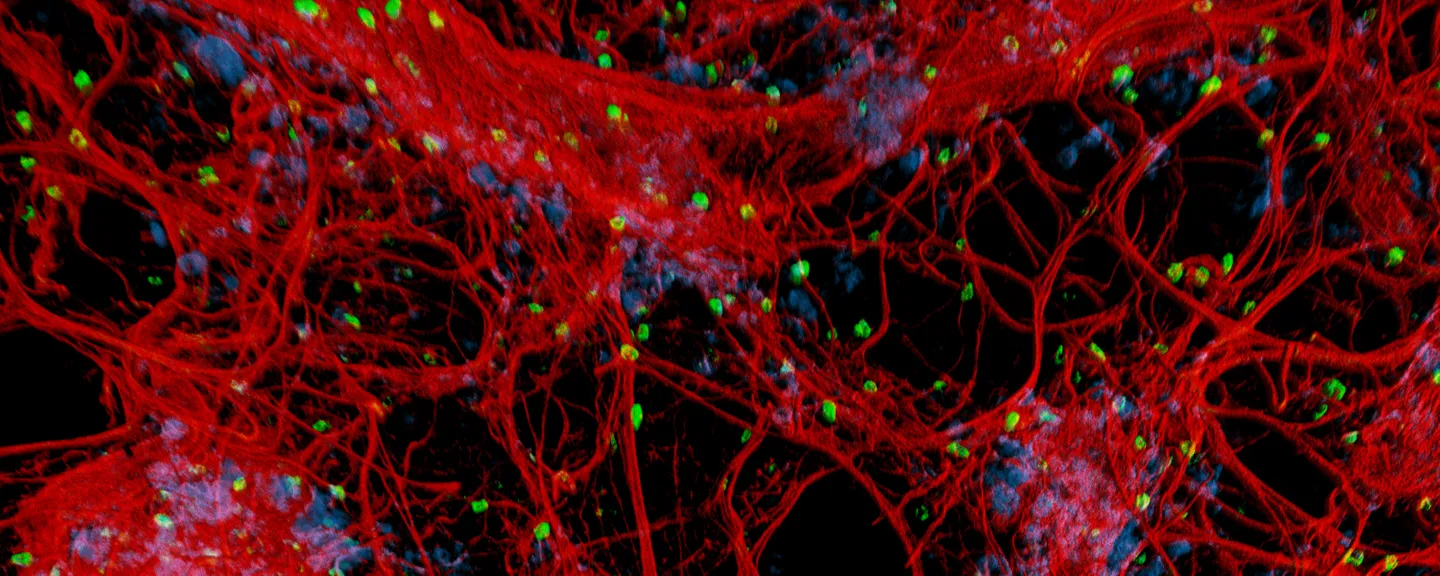 A photo of human lung vasculature
