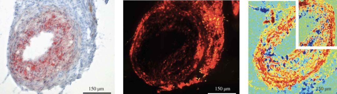 Brillouin imaging