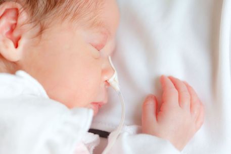 Baby with nasal oxygen tube