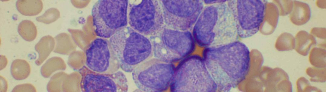 peripheral blood morphology