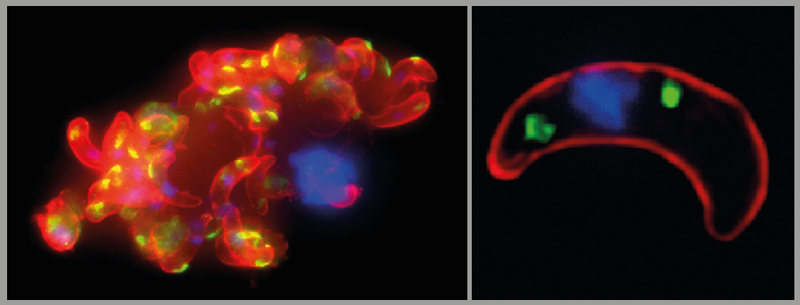 Cell Host and Microbe STM paper 2023 - parasite photo