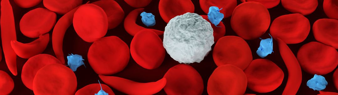 3d illustration of sickle cell anemia red blood cells