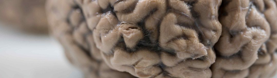 Physics of brains 