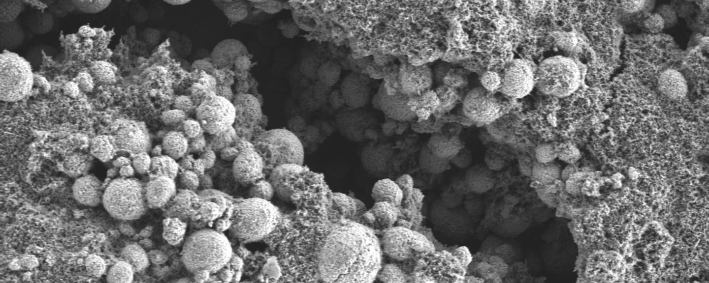 Nickel Molybdenum Cobalt battery cathode captured by scanning electron microscopy