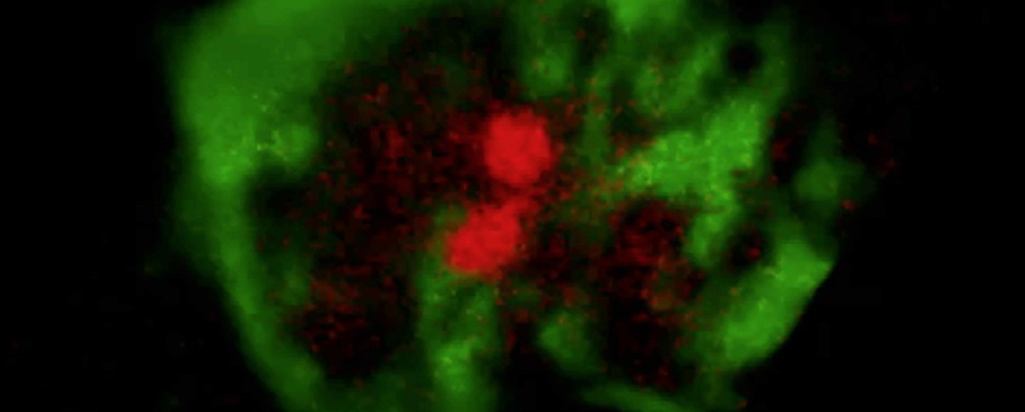 Bone Marrow Dynamics