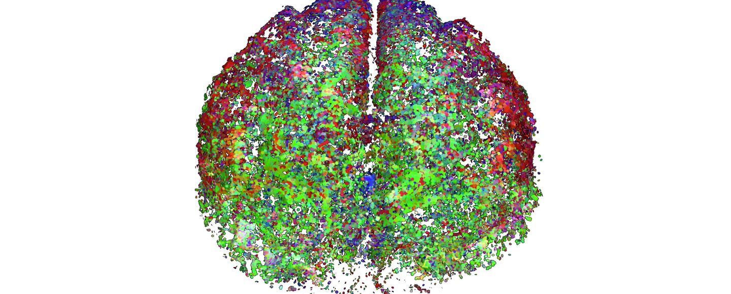 Brain
