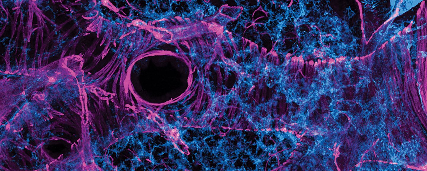 Photo of capillary vessels network (blue) and smooth muscle (purple) around a large airway of mouse lungs