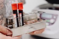 A picture of blood test vials and holder being held in a lab