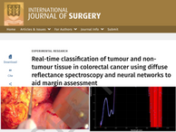 Real-time classification of tumour and non-tumour tissue in colorectal cancer using diffuse reflectance spectroscopy and neural networks to aid margin assessment
