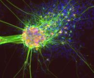 Fluorescent image of neuron cell