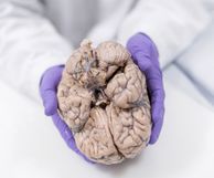 Hands holding human brain in laboratory