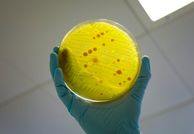 A gloved hand holds a yellow petri dish with colonies