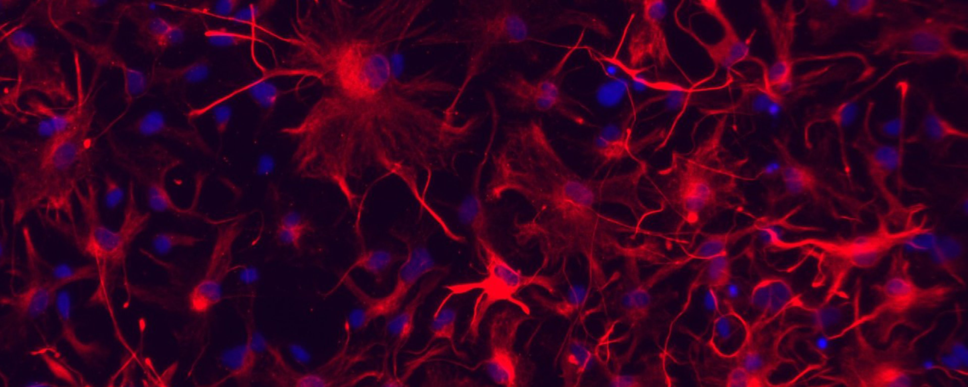 iPSC Expertise | Research groups | Imperial College London