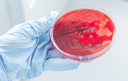 Professor Shiranee Sriskandan looking at Streptococcus pyogenes in a petri dish.