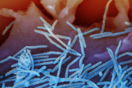 Scanning electron micrograph of human respiratory syncytial virus (RSV) virions (colorized blue) and labeled with anti-RSV F protein/gold antibodies (colorized yellow) shedding from the surface of human lung epithelial A549 cells. Credit: NIAID