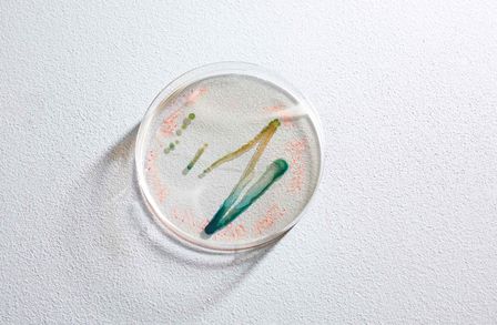 Cyanobacteria on an agar plate 