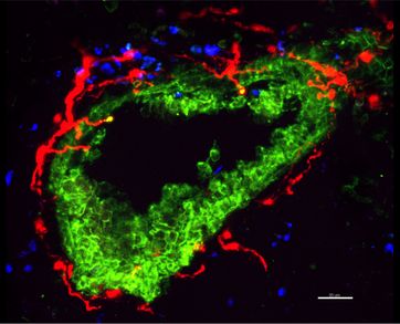 Increased nerve innervation in the bronchial epithelium