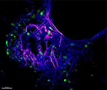 Second Harmonic Generation imaging of fixed PCLS showing a mesh of perbronchial collagen and GFP+ ILC2 attached to fibrillar collagen fibers