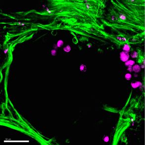 High resolution image depicting association of immune and structural cells in human lung