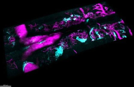 Bone Marrow and Stem Cells