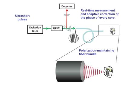 Detector