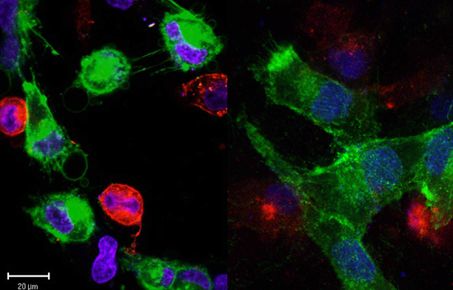 Confocal images of CAFs and PCa cells 