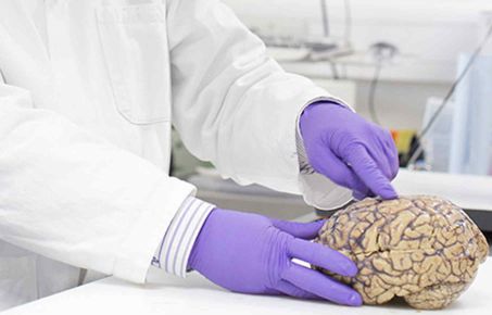 Human brain being examined in a lab