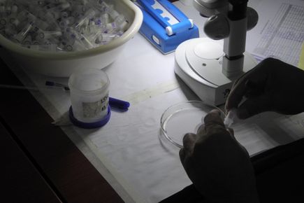 Hands unscrew a small vial under microscope light