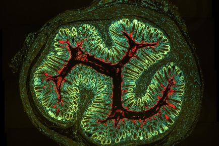 Bacterial pathogenesis theme