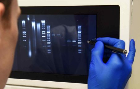 Analysis of gel image