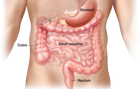 Cancer GI tract 