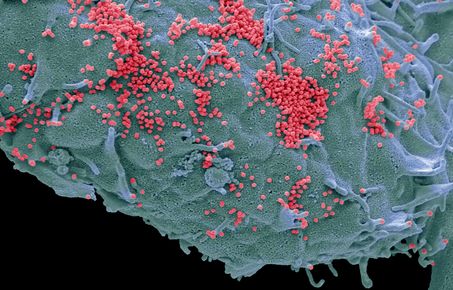 293T cells infected with influenza