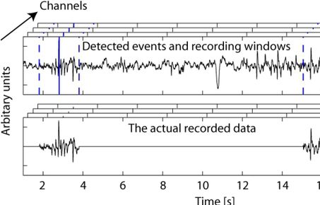 Epilepsy Monitoring