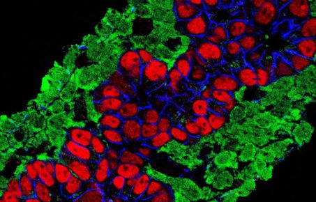 Pancreatic islet biology and diabetes