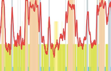 Sleep Monitoring and Analysis