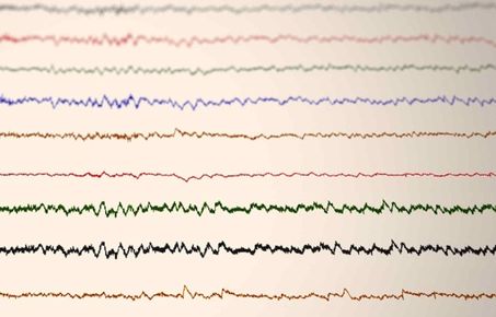 Brain Monitoring