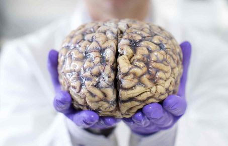 Brain Sciences