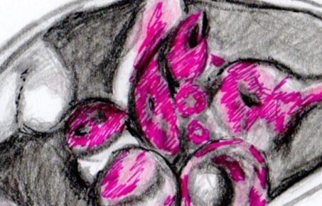 art and science drawing of TD tomato tagged Phytopthora palmivora germinating sporangia