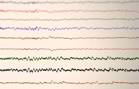 Brain Monitoring
