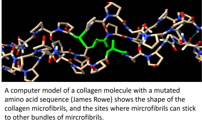 omputer model of a collagen molecule with mutated amino acid sequence (James Rowe) showing the shape of the collagen microfibril,. and the sites where mircrofibrils can stick to other bundles of mircorbrils. those sticky bonds are the molecular basis of the stiffness we feel every morning. By understanding these sites, and how collagen fibrils stick to one another, we are closer to understanding t