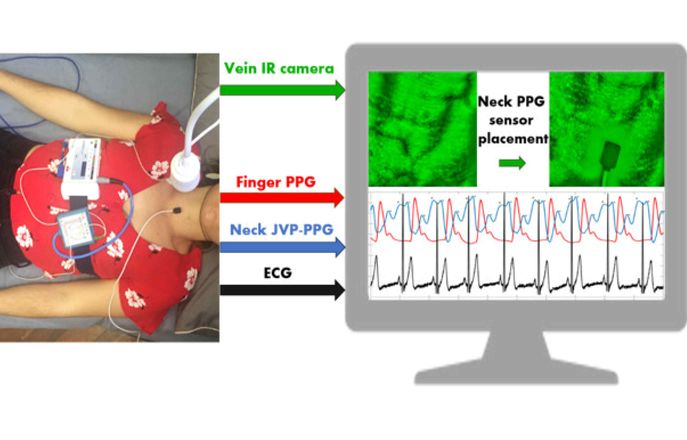 Polysomnograph setup on user to avquire Jugular Vein Pulse